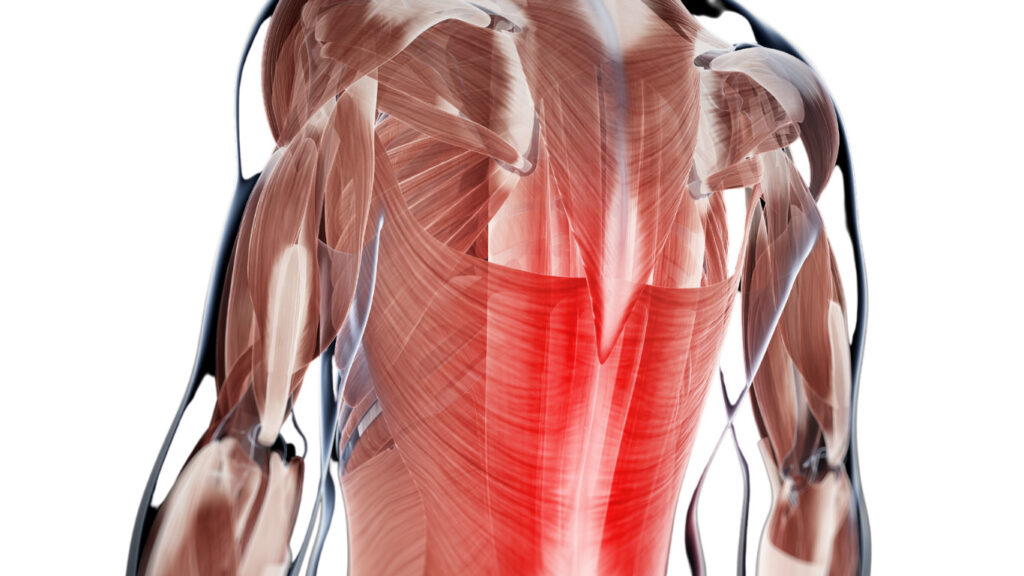 反り腰　原因　筋肉